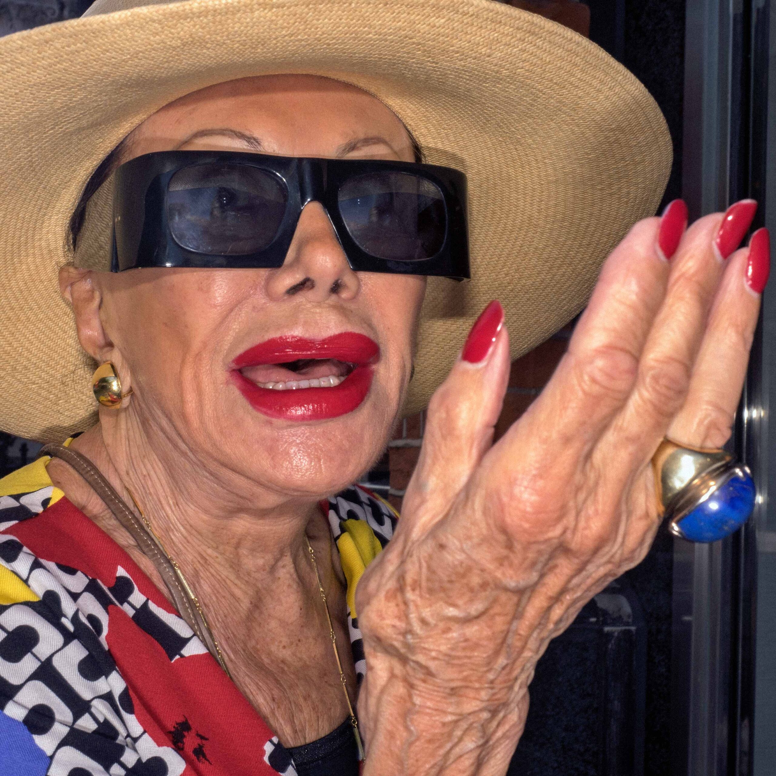 WREN-DougieWallace-made in chelsea-face lift duck